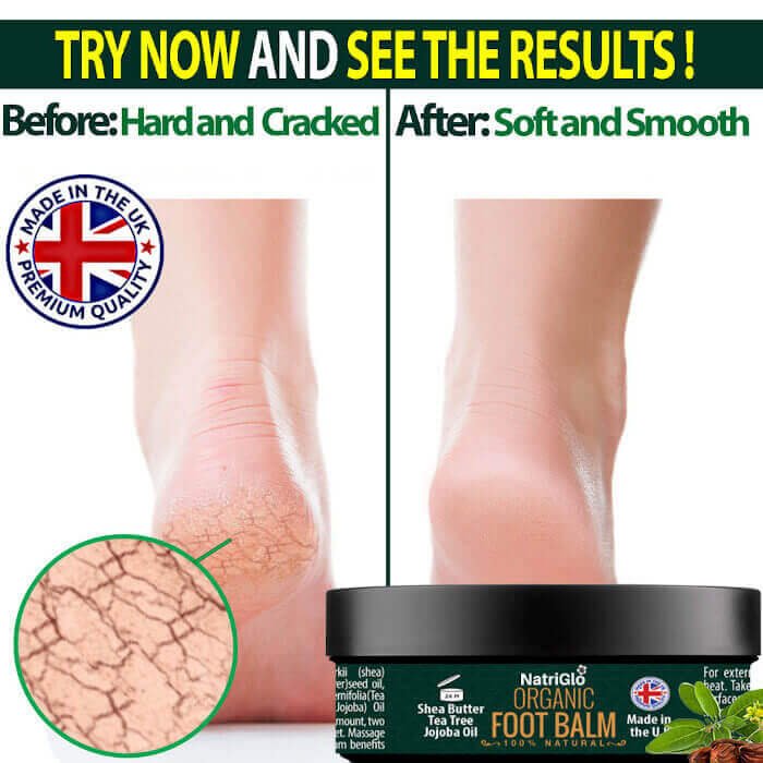 Best Organic Foot Cream for Cracked Heels and Dry Skin UK